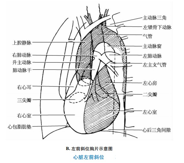 心脏左前斜位图片