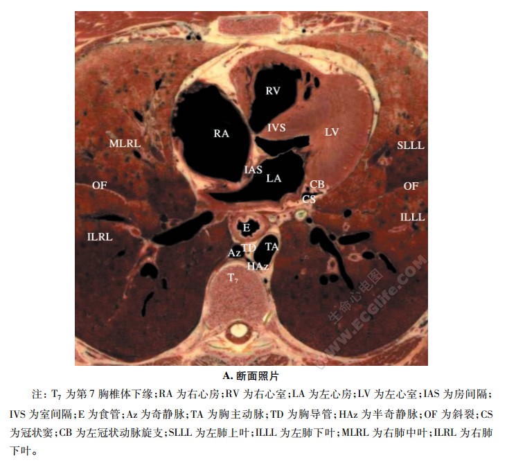 平第7胸椎体下缘横断面解剖图