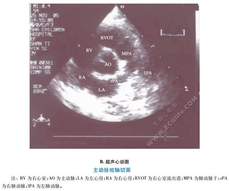 短轴超声切面