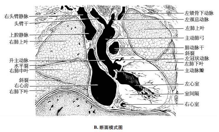 心脏经升主动脉冠状断面示意图