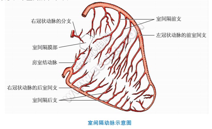 室间隔动脉分布示意图