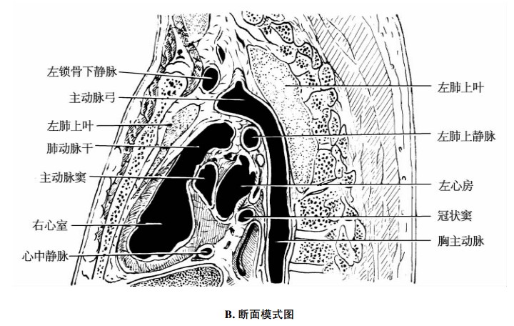 心脏左旁正中矢状断面示意图