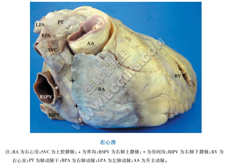 右心房外形与位置解剖图