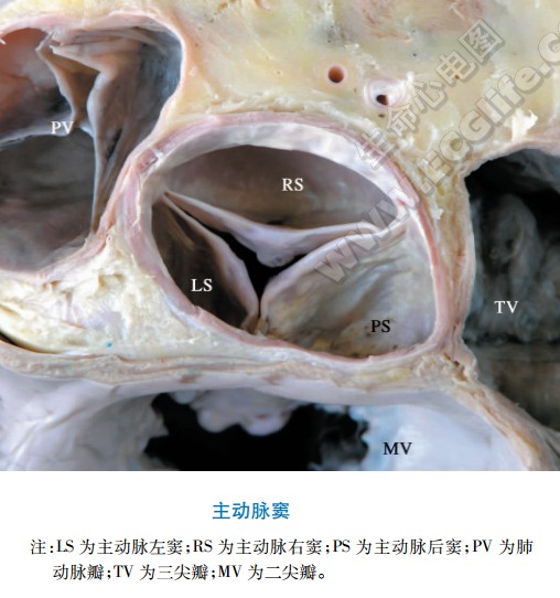 主动脉窦解剖图三维图片