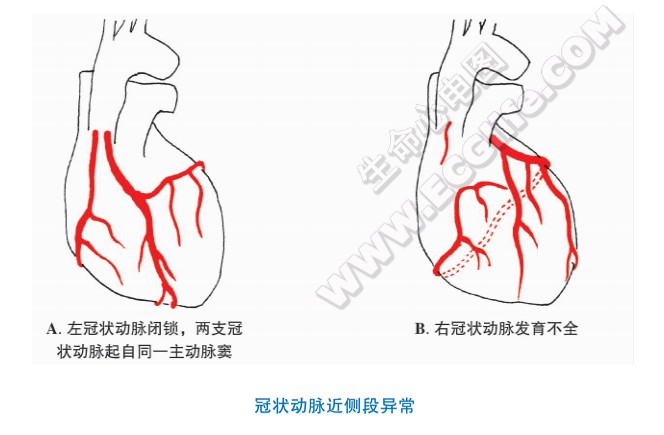 冠状动脉起自肺动脉干