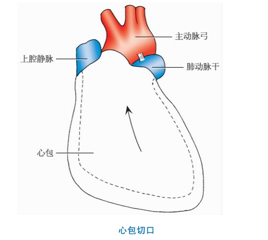 剪开心包解剖操作