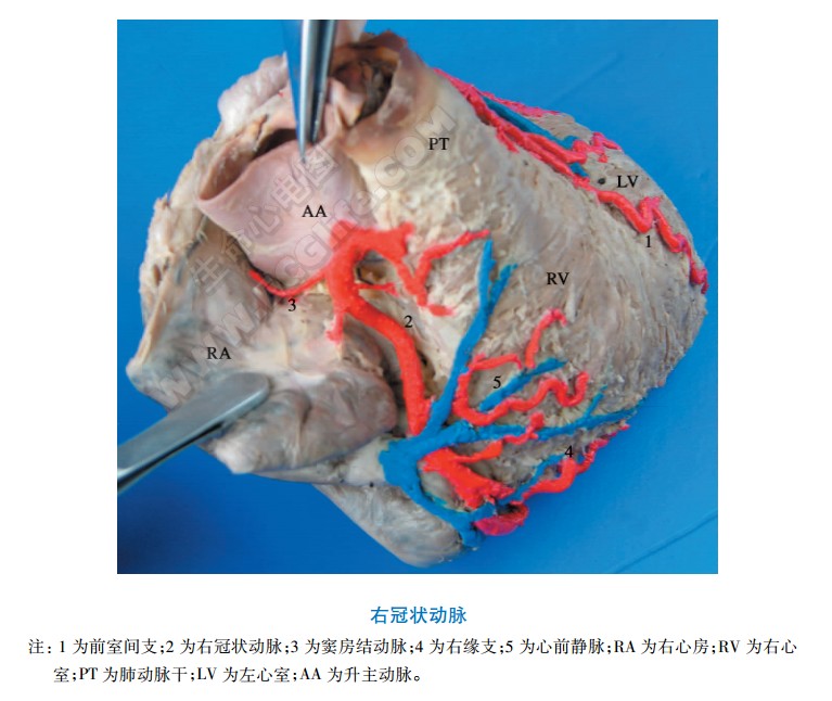 心脏右冠状动脉结构分布解剖图