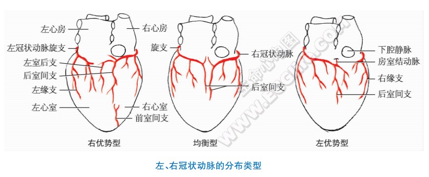 左、右冠状动脉的三种