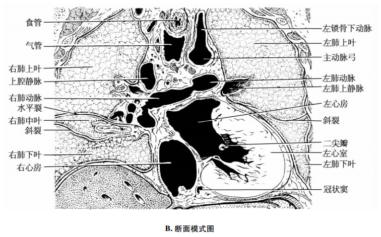 心脏经肺动脉权冠状断面示意图