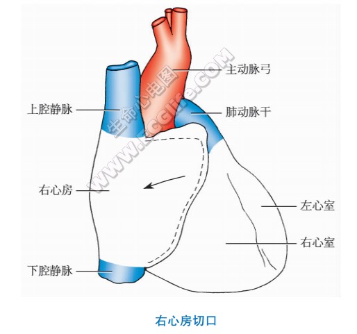 右心房解剖切口