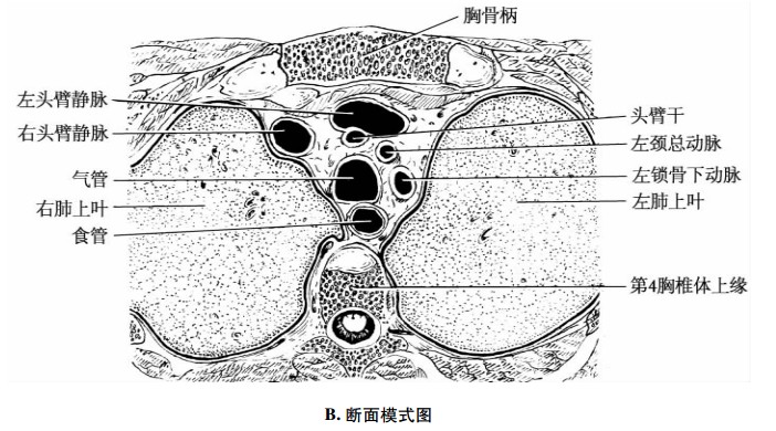 平第4胸椎体上缘横断面示意图