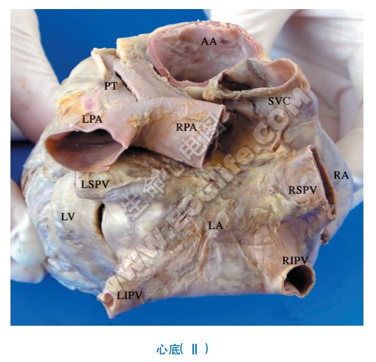 心底解剖图2