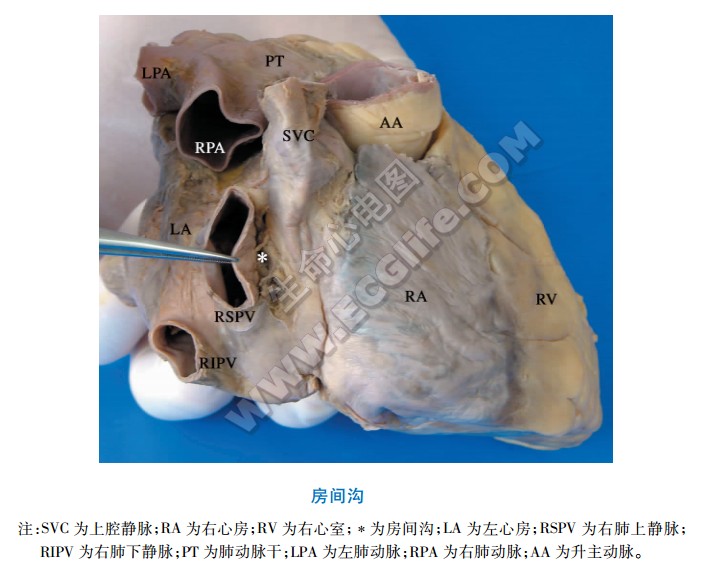 房间沟解剖图