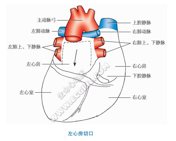 左心房解剖切口