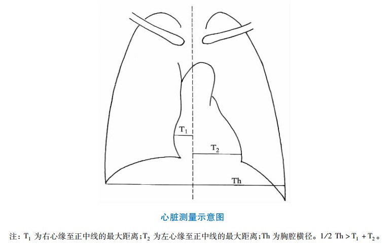 X线胸片心脏测量