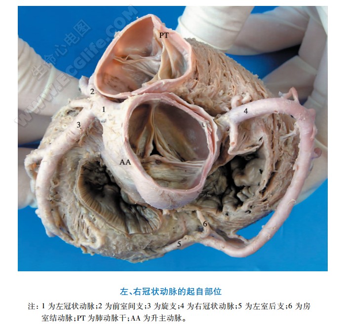 左冠状动脉、右冠状动脉的起自部位