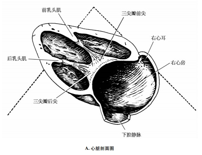 右室流出道示意图图片