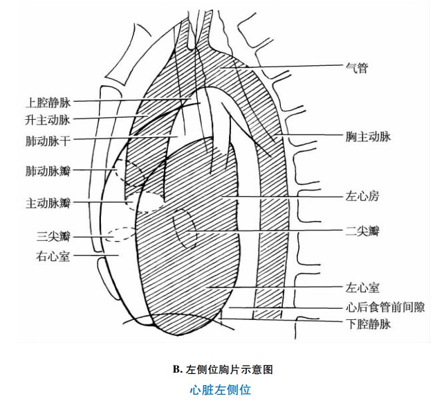 左侧位胸片示意图