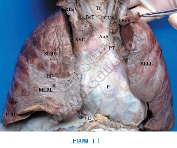 上纵隔解剖图