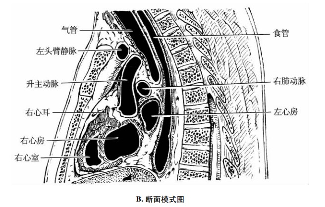 心脏正中矢状断面示意图