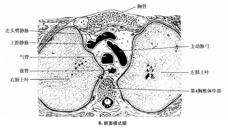 平第4胸椎体中部横断面示意图