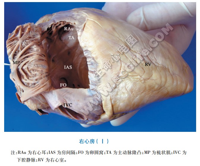 右心房腔内结构解剖图