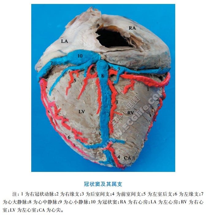 冠状窦及其属支组成分布图、解剖图