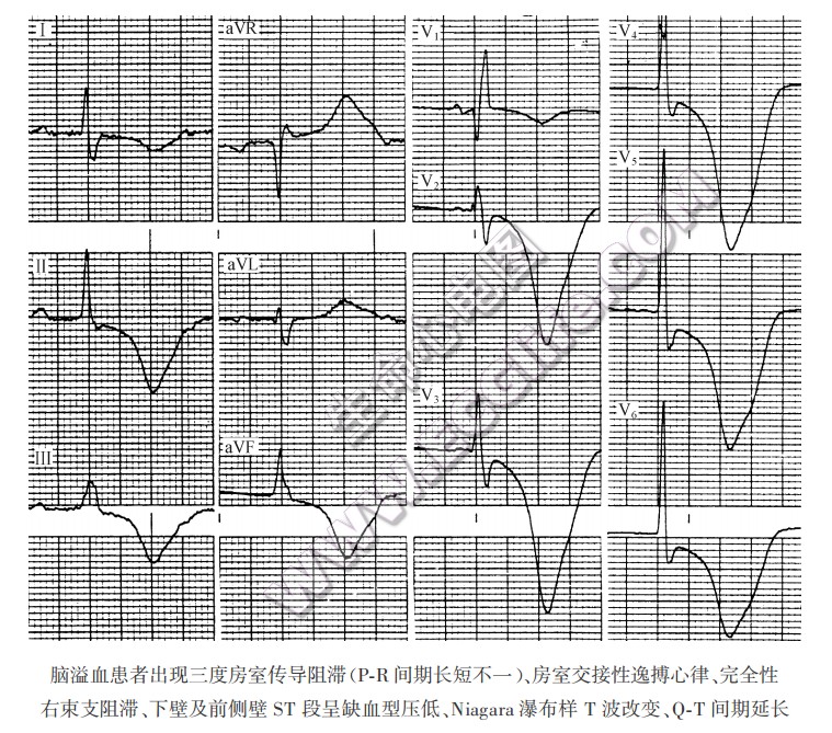 尼亚加拉大瀑布样t波图片