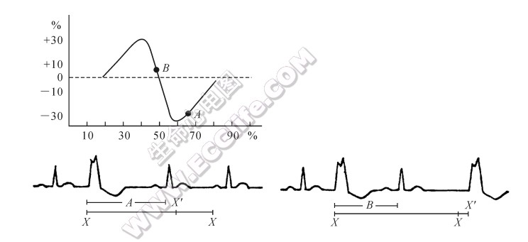 双相性时相反应曲线示意图（心电图）