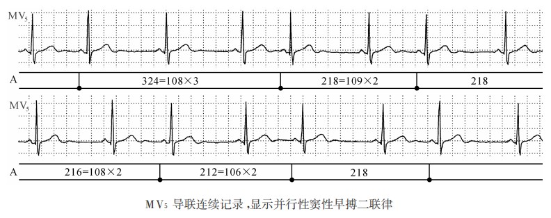 窦房结内两个节律点交替地发放激动