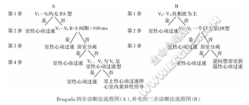 Brugada四步诊断法流程图(A)、补充的三步诊断法流程图(B)