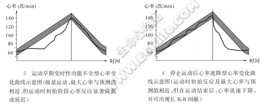 与运动有关的变时性功能不全