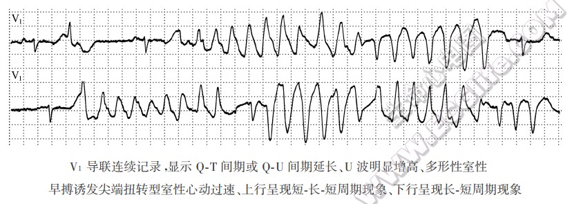 短长短周期现象