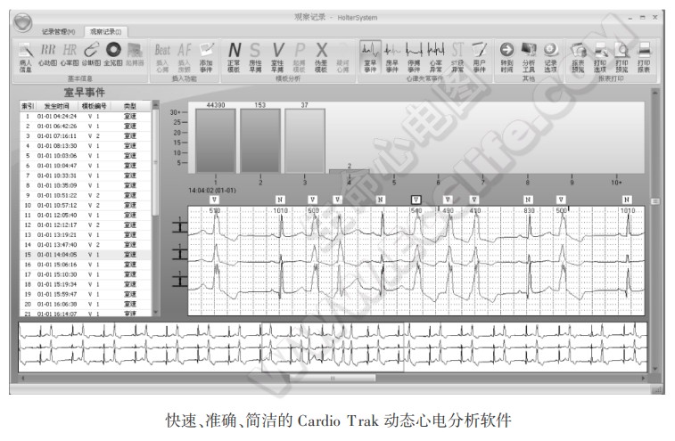 CT-08动态心电记录盒