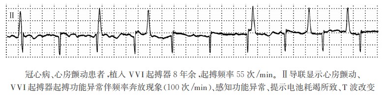 奔放现象