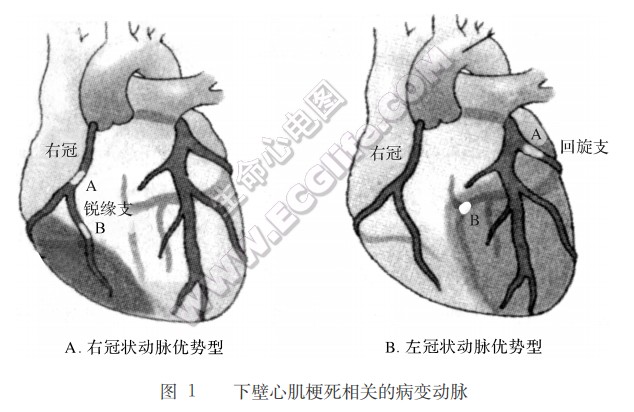 定位诊断与相关动脉病变部位的判断