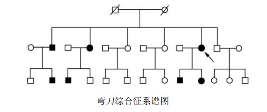 弯刀综合征（心肺发育不全军刀综合征）系谱图