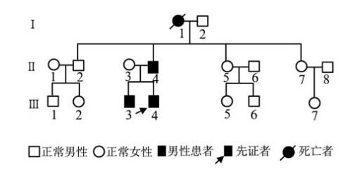 Marchesani综合征（短指-晶状体异位综合征）