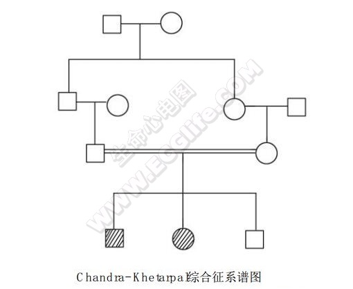 Chandra-Khetarpal综合征（支气管扩张-鼻窦旁不发育-左位心综合征）系谱图