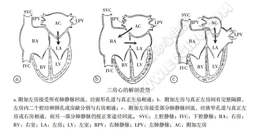 三房心的分类