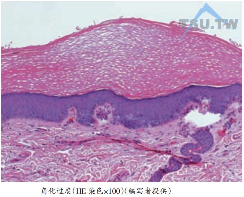 皮肤表皮的变化