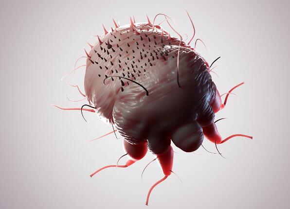 疥疮（由疥螨引起的感染）：症状、诊断、治疗参考