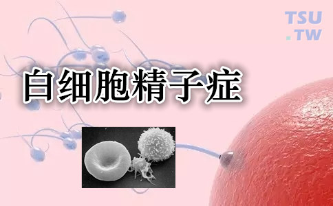 白细胞精子症：白细胞的意义、病因、诊断及治疗