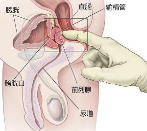 什么是前列腺？有什么作用？