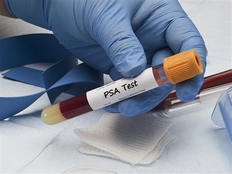 血液PSA检测