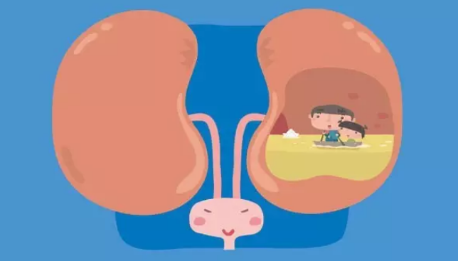 前列腺增生为什么会引起肾积水？