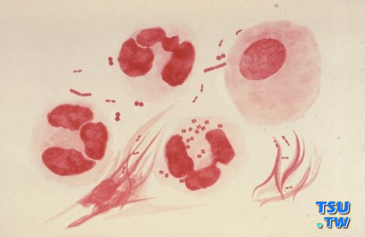 淋球菌镜下形态图片