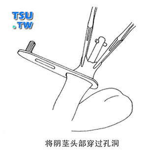 将阴茎头部穿过孔洞