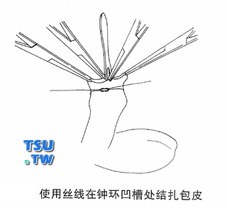 使用丝线在钟环凹槽处结扎包皮