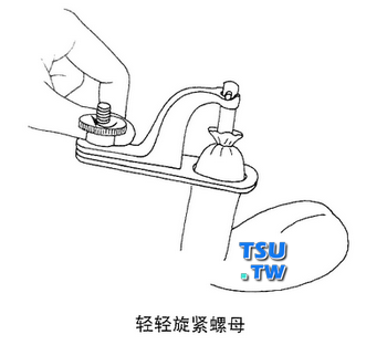 Gomco钳环切割包皮手术法解读